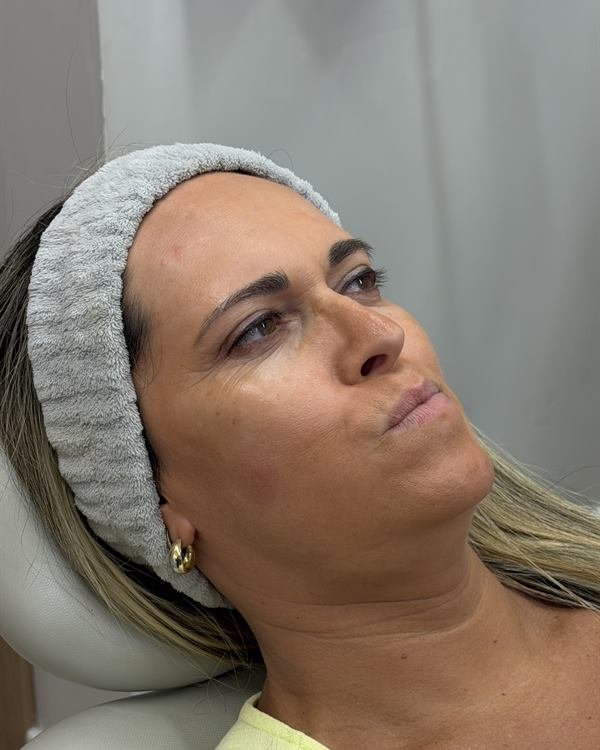 Paciente em três quartos, antes do procedimento