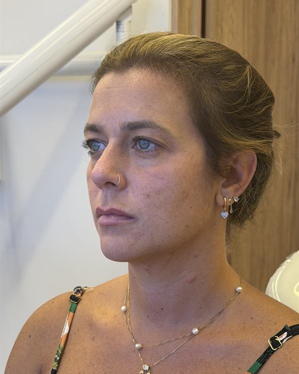 Paciente em três quartos, antes do procedimento